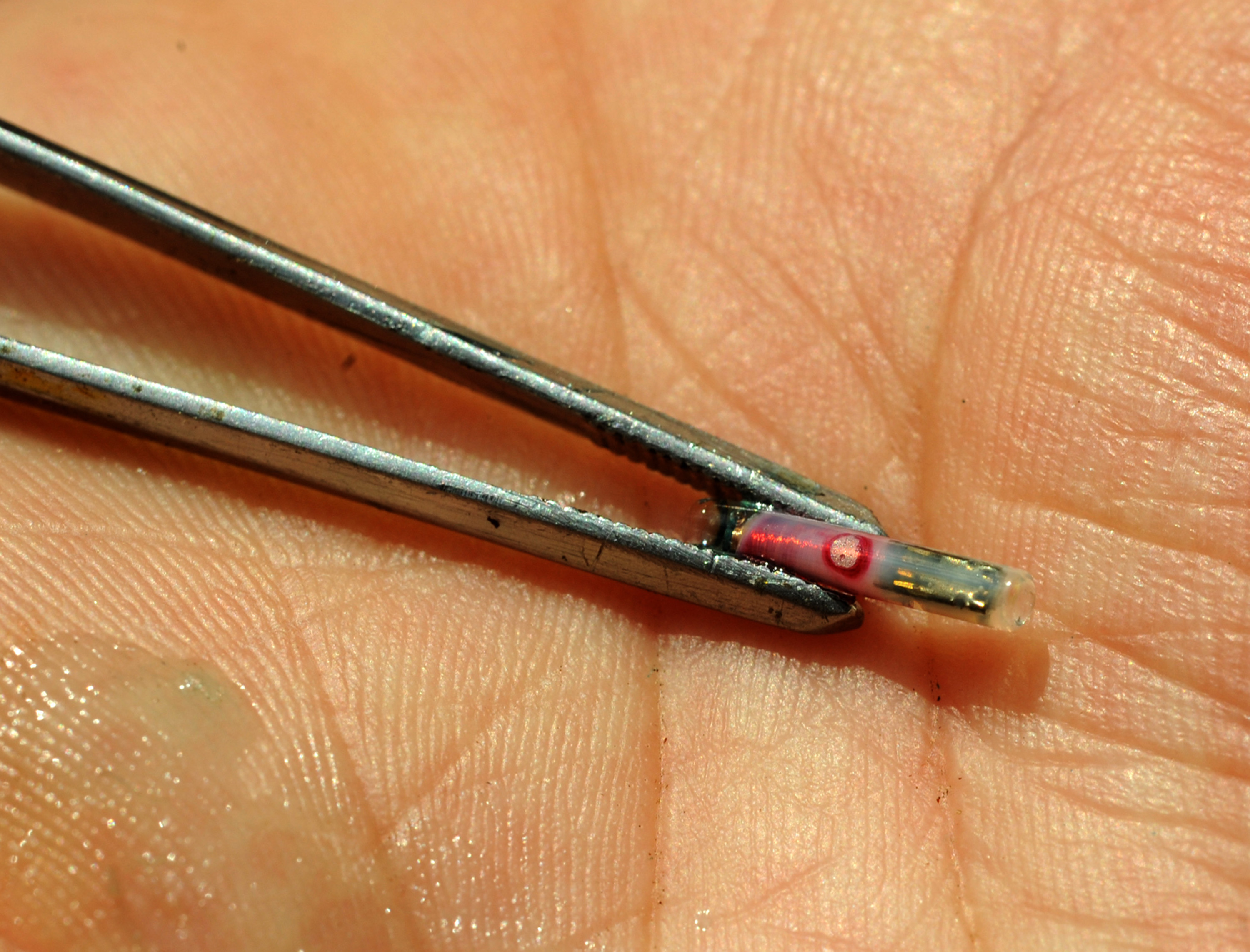 New surgical microchips the key to the future The Spectator